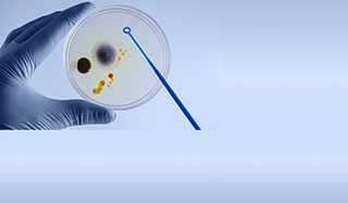 Biodiesel e il Diesel bug